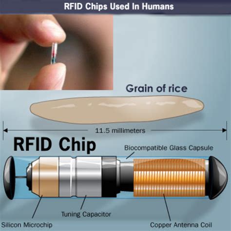 rfid chip removal|how to turn off microchips.